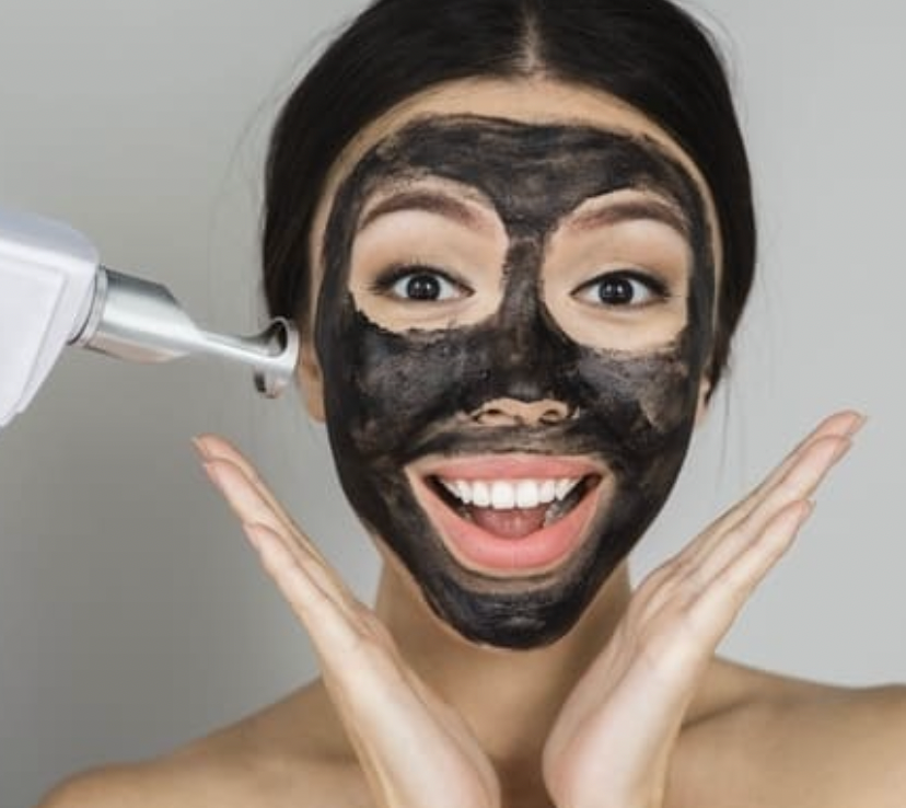 Carbon Peel